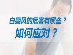 白癜风的治疗费用是怎样构成的