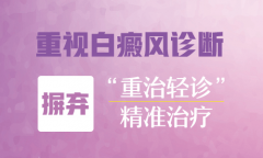 昆明白癜风医院谈论稳定期白癜风症状怎么诊断